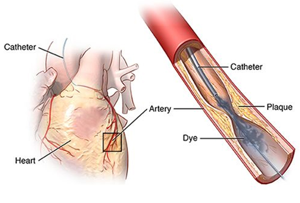 best hospital in jaipur|Gadhwal Heart & General Hospital