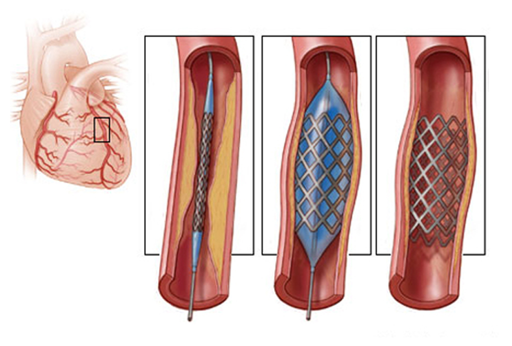 best hospital in jaipur|Gadhwal Heart & General Hospital