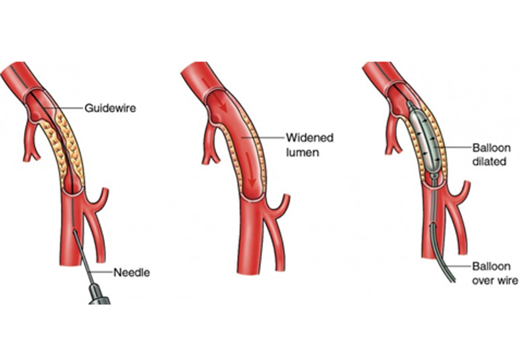 best hospital in jaipur|Gadhwal Heart & General Hospital